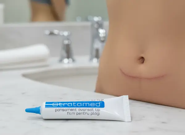 Stratamed, gel de silicon pentru cicatrici