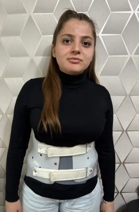Sprijin pentru Alexandra Gabriela Pițur, adolescentă de 15 ani diagnosticată cu scolioză severă