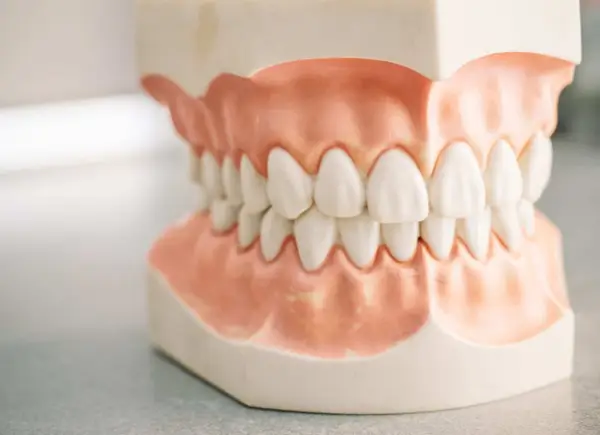 Cât costă o dantură completă pe implanturi la LLL Dental