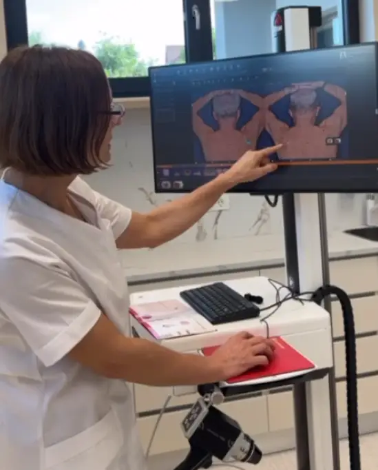 Cartografiere alunite si monitorizare dermatologica