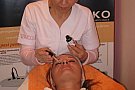 Tratament pentru acnee Tarda by Salon Dermocenter