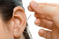 Auriculoterapia - acupunctura urechii