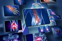 Terapia Tim