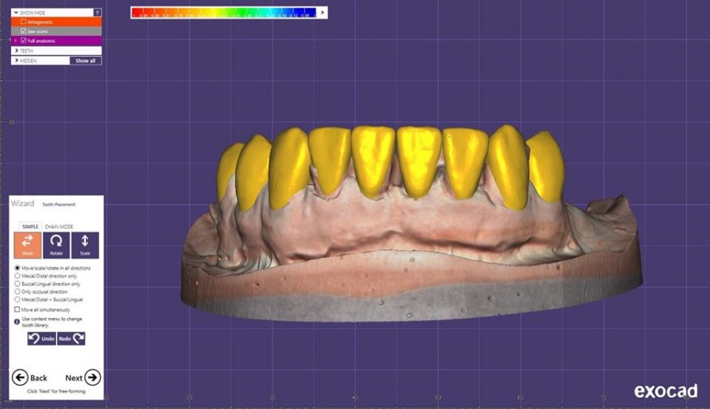 Laborator Tehnica Dentara Metaldent