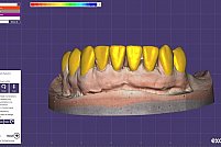 Laborator Tehnica Dentara Metaldent