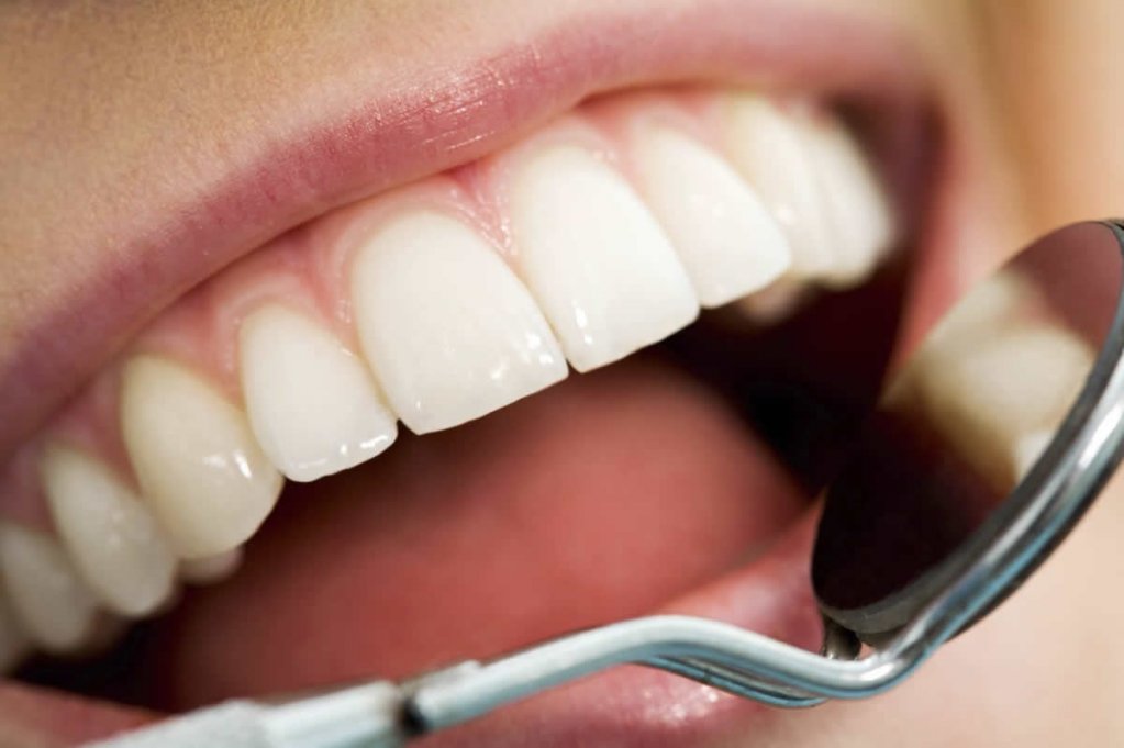 9 lucruri pe care nu le stiai despre parodontoza!