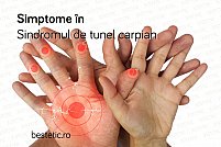 Cum se pune diagnosticul in sindromul de tunel carpian
