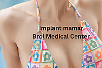 Implanturile mamare: Alegerea perfectă pentru o siluetă fermecătoare