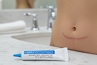 Stratamed, gel de silicon pentru cicatrici