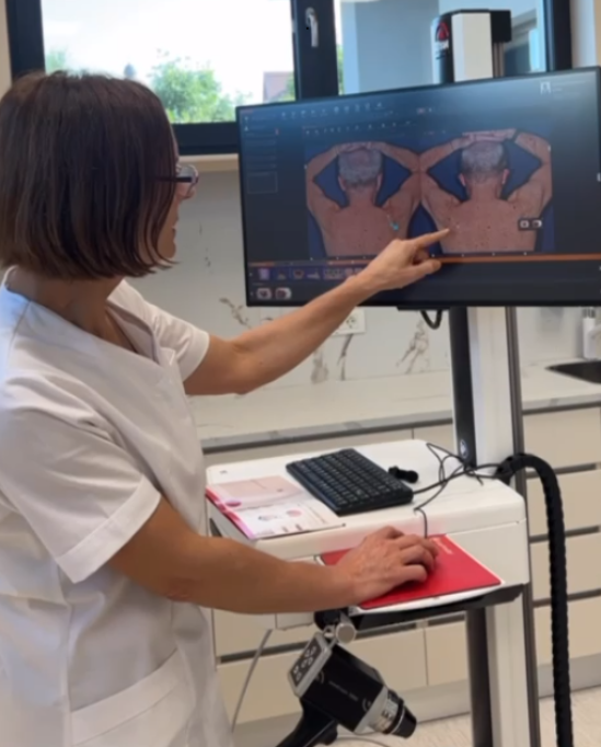 Cartografiere alunite si monitorizare dermatologica