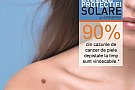 Zilele Protectiei Solare. Campanie nationala de testari gratuite pentru al