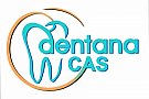 Dentana Cas 