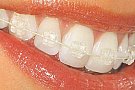 Neoclinique